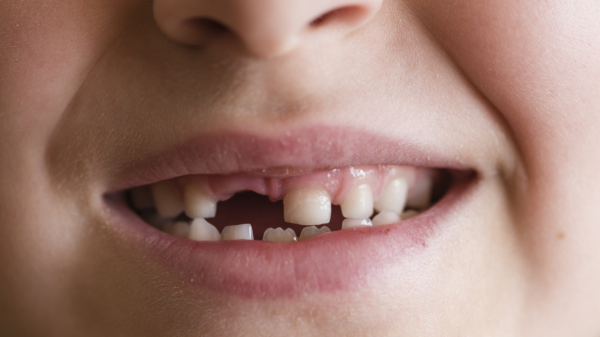 Shrootless: Microsoft finds Apple macOS vulnerability