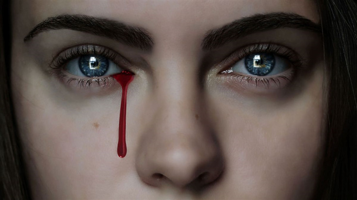 a woman bleeding blood from one eye
